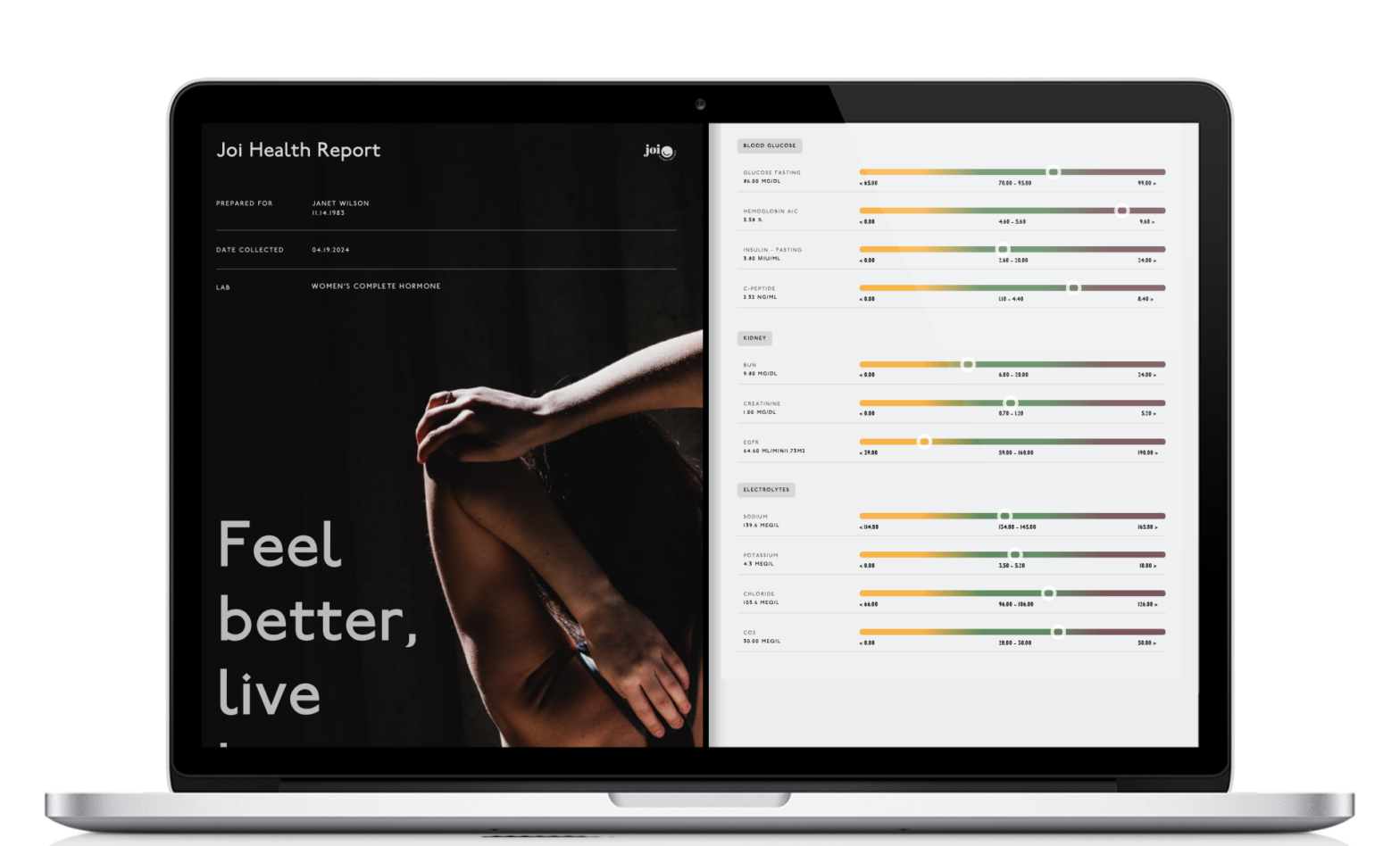 Complete Hormone Panel